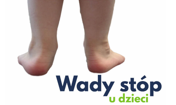 Wady stóp u dzieci