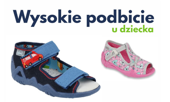 Wysokie podbicie u dziecka